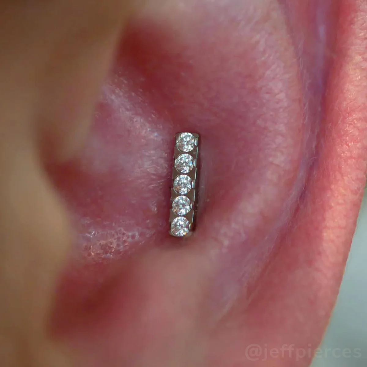Titanium Gem Bar Ends - Image 7